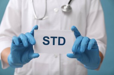 Açık mavi zemin üzerinde STD kısaltması olan kağıt tutucu doktor, yakın plan.