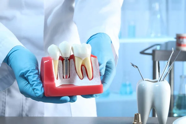 Dentist Holding Educational Model Gum Dental Implant Teeth Indoors Closeup — Stockfoto