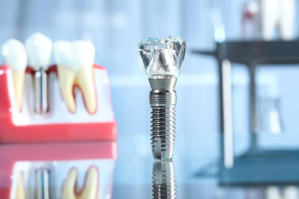 Modelo Educativo Implante Dental Sobre Fondo Borroso — Foto de Stock