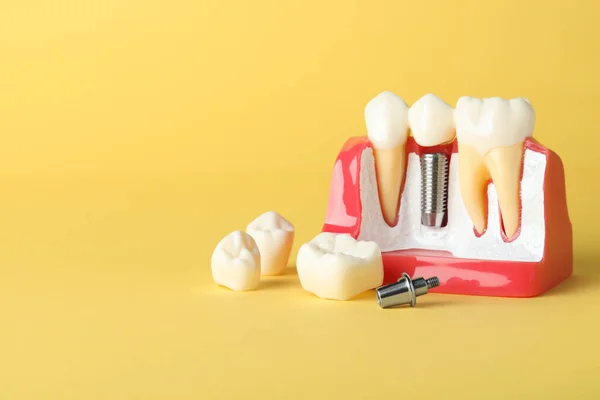 Освітня Модель Гумки Зубною Імплантацією Між Зубами Жовтому Тлі Простір — стокове фото