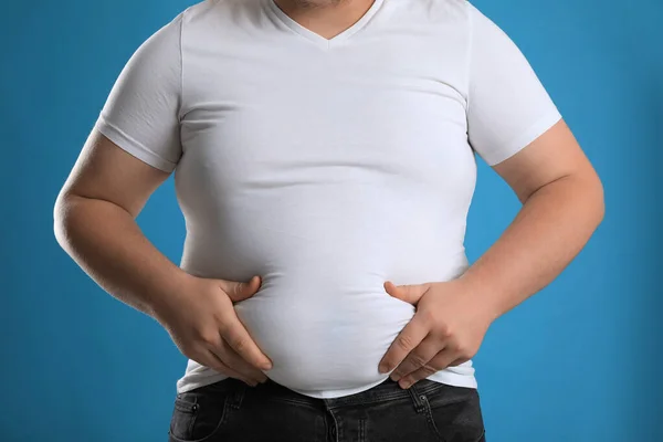 Overweight Man Tight Clothes White Background Closeup Stock Photo