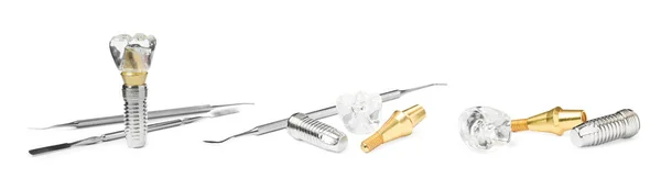 Diş Implantlarının Eğitici Modelleri Beyaz Arka Planda Tıbbi Aletler Kolaj — Stok fotoğraf