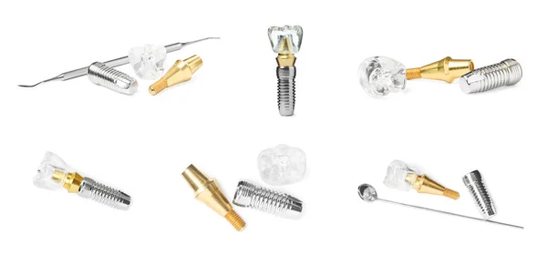 Modèles Éducatifs Implants Dentaires Outils Médicaux Sur Fond Blanc Collage — Photo
