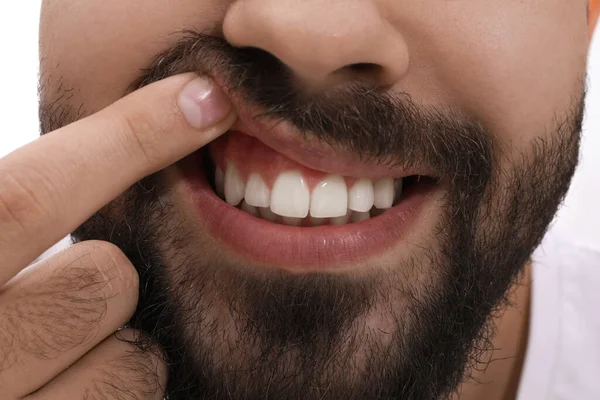 Junger Mann Zeigt Weiße Zähne Nahaufnahme — Stockfoto