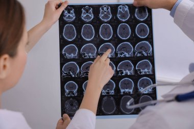 Doktorlar klinikte çoklu sklerozlu hastanın MRI görüntülerini inceliyor.