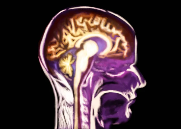 Scan Van Menselijk Hersengebied Zwarte Achtergrond Illustratie — Stockfoto