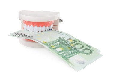Beyaz arka planda euro banknotları olan eğitici bir dişçi tipodu modeli. Pahalı tedavi