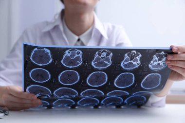Doktor, klinikteki masadaki çoklu sklerozlu hastanın MRI görüntülerini inceliyor.