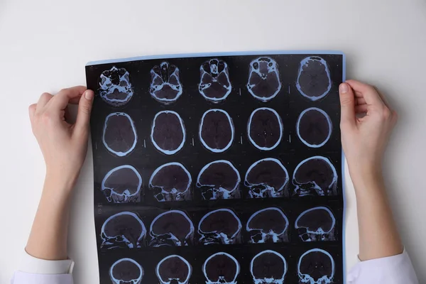 Médico Examinando Imagens Paciente Com Esclerose Múltipla Tabela Branca Vista — Fotografia de Stock