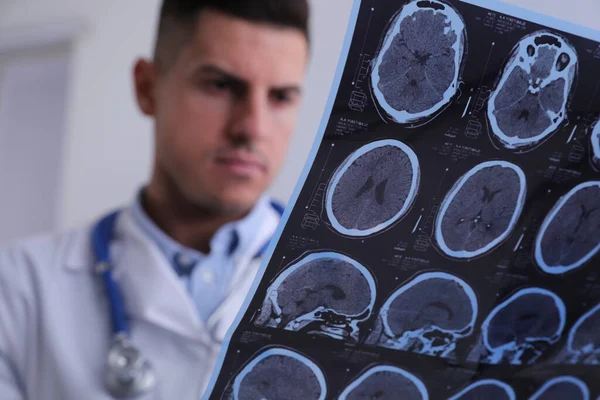 Médico Examinando Imágenes Resonancia Magnética Del Paciente Con Esclerosis Múltiple — Foto de Stock