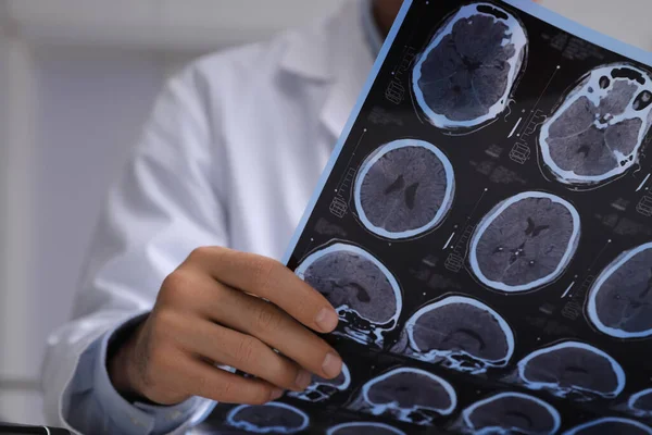 Doktor, klinikte çoklu sklerozlu hastanın MRI görüntülerini inceliyor.