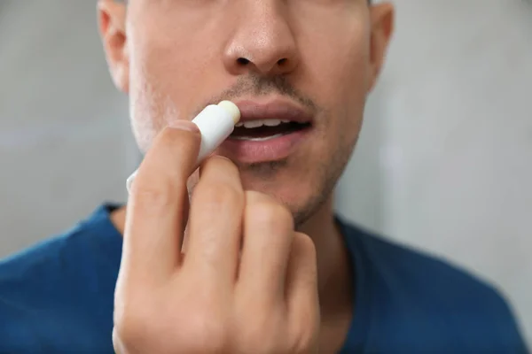 Άνθρωπος Εφαρμογή Υγιεινό Lip Balm Γκρι Φόντο Closeup — Φωτογραφία Αρχείου