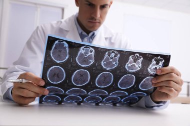 Doktor, klinikteki masadaki çoklu sklerozlu hastanın MRI görüntülerini inceliyor.