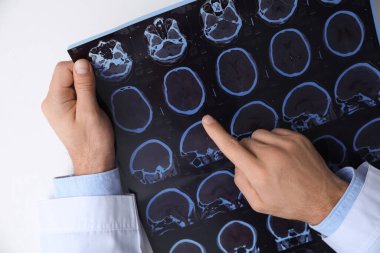 Doktor, beyaz masada çoklu sklerozlu hastanın MRI görüntülerini inceliyor.