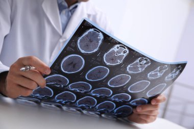 Doktor, klinikteki masadaki çoklu sklerozlu hastanın MRI görüntülerini inceliyor.