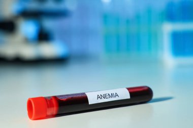 Üzerinde kan örneği olan test tüpü ve beyaz masada bulanık arkaplan ile yakın plan Anemia etiketi. Metin için boşluk