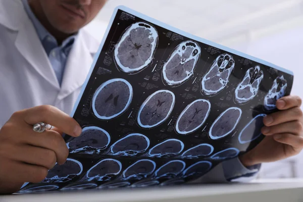 Médico Examinando Imágenes Resonancia Magnética Del Paciente Con Esclerosis Múltiple — Foto de Stock