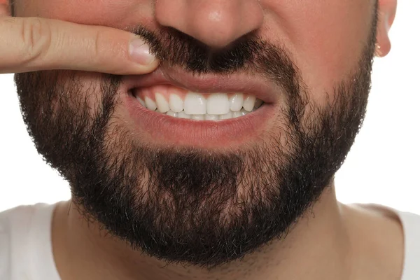 Młody Mężczyzna Pokazuje Białe Zęby Widok Bliska — Zdjęcie stockowe