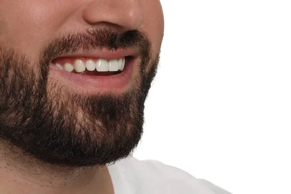 Feliz Joven Con Dientes Sanos Sobre Fondo Blanco Primer Plano —  Fotos de Stock