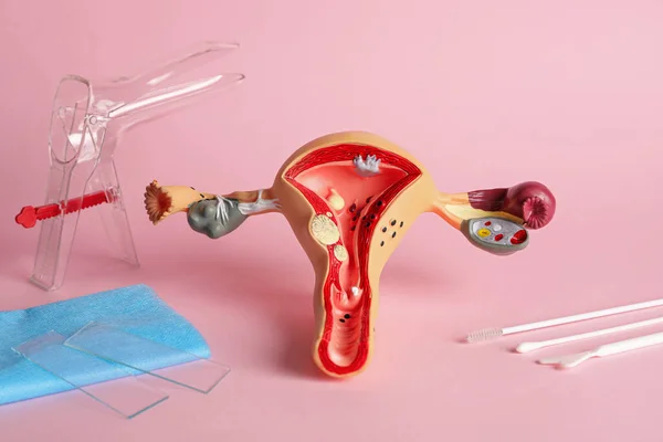 Gynecological Examination Kit Anatomical Uterus Model Pink Background — Stock Photo, Image