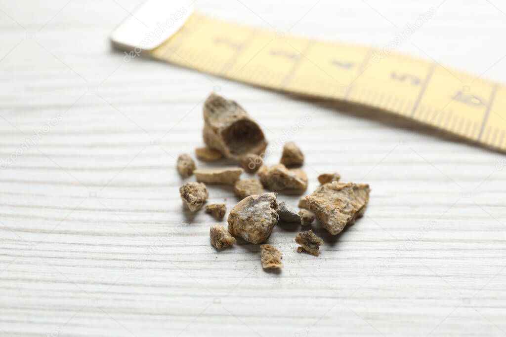 Kidney stones and measuring tape on white wooden table, closeup