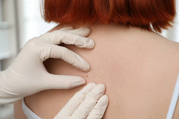 Dermatolog Klinikte Hastanın Doğum Lekesini Inceliyor — Stok fotoğraf