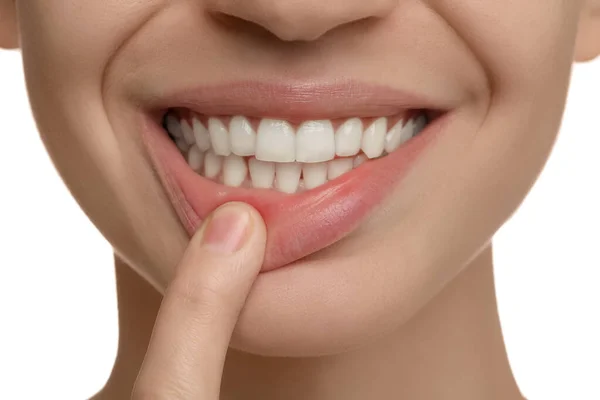 Mujer Con Dientes Sanos Sobre Fondo Blanco Primer Plano — Foto de Stock