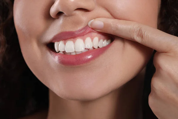 Young Woman Showing Healthy Gums Closeup View — Stock Photo, Image