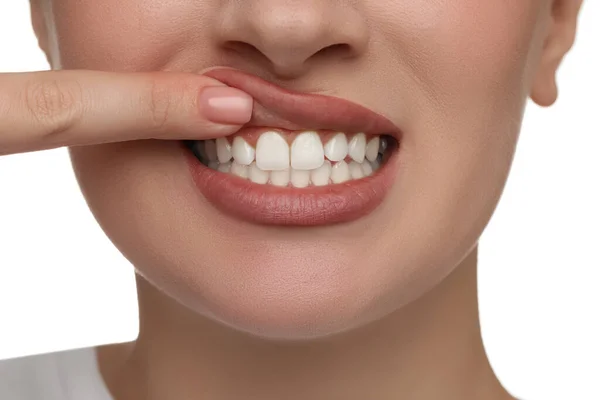 Vrouw Met Gezonde Tanden Witte Achtergrond Close — Stockfoto