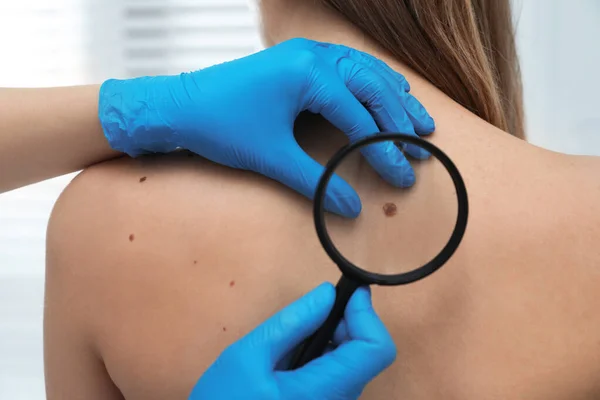 Dermatologo Che Esamina Voglia Del Paziente Con Lente Ingrandimento Clinica — Foto Stock