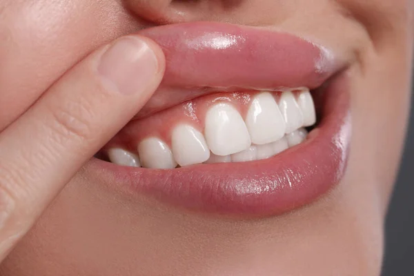 Junge Frau Zeigt Gesundes Zahnfleisch Nahaufnahme — Stockfoto