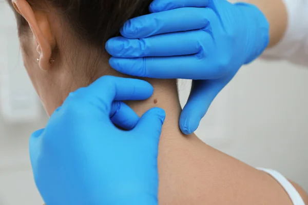 Dermatologist Examining Patient Birthmark Clinic Closeup View — Stock Photo, Image