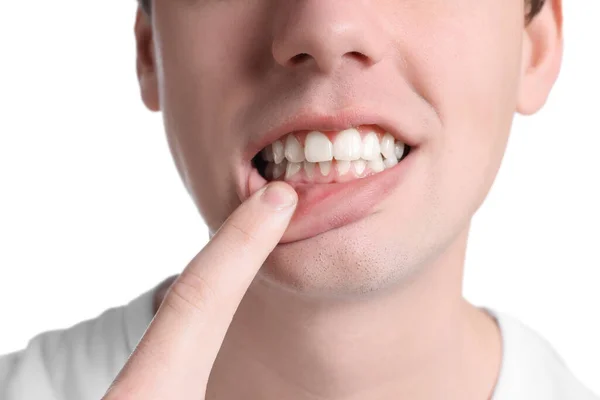 白い背景に健康な歯茎を示す男の子 クローズアップ — ストック写真