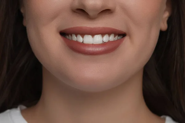 Mujer Joven Con Dientes Blancos Sanos Primer Plano — Foto de Stock