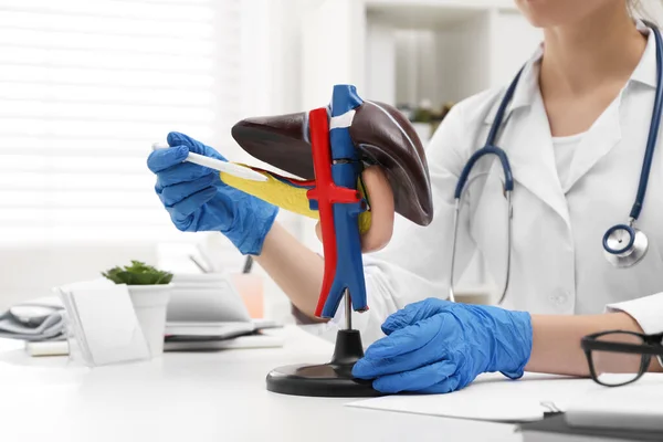 Lekarz Demonstrujący Model Wątroby Przy Stole Klinice Zbliżenie — Zdjęcie stockowe