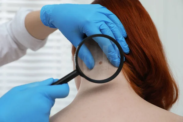 Dermatoloog Onderzoekt Moedervlek Van Patiënt Met Vergrootglas Kliniek Close View — Stockfoto