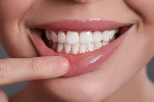 Sağlıklı Diş Etleri Gösteren Genç Bir Kadın Yakın Çekim — Stok fotoğraf