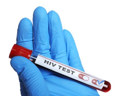 Bilim adamları, üzerinde kan örneği olan tüp tutuyorlar ve beyaz arka plan üzerinde HIV testi etiketliyorlar.