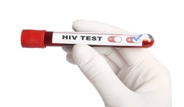 Bilim adamları, üzerinde kan örneği olan tüp tutuyorlar ve beyaz arka plan üzerinde HIV testi etiketliyorlar.