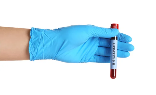 Científico Sosteniendo Tubo Con Muestra Sangre Etiqueta Hepatitis Sobre Fondo — Foto de Stock