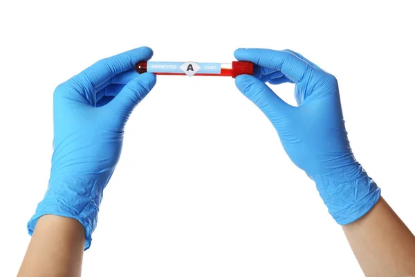 Científico Sosteniendo Tubo Con Muestra Sangre Etiqueta Hepatitis Prueba Sobre — Foto de Stock