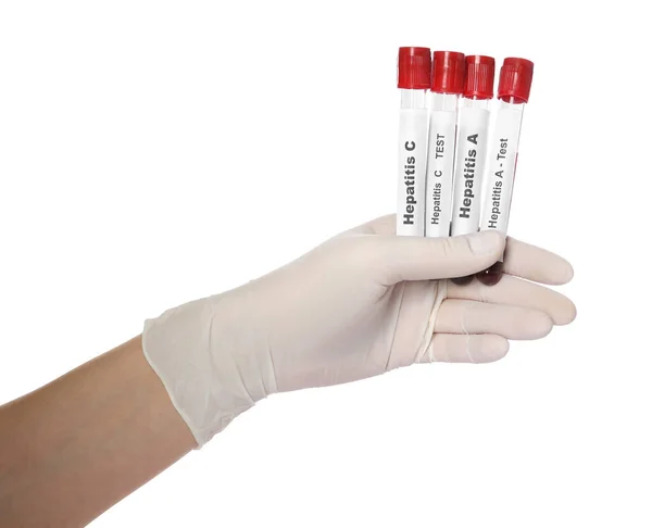 Scientist Holding Tubes Blood Samples Hepatitis Virus Test White Background — Stock Photo, Image
