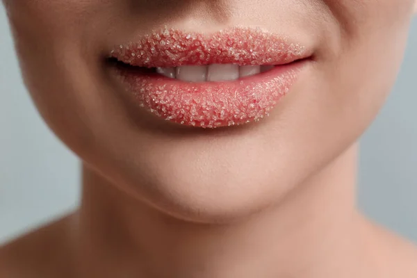 明るい灰色の背景に砂糖で覆われた唇を持つ女性のクローズアップビュー — ストック写真