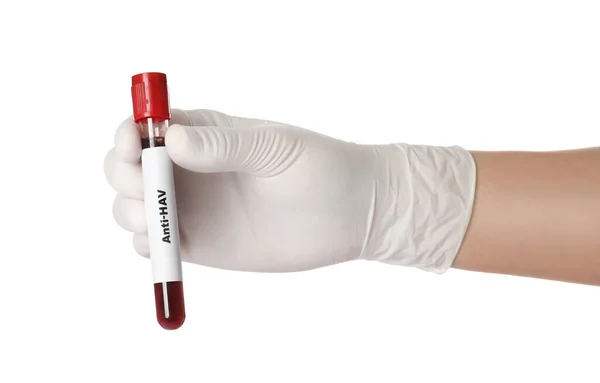 Scientist Holding Tube Blood Sample Label Hav White Background Closeup — Stock Photo, Image