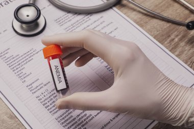 Doktor elinde kan örneğiyle test tüpü tutuyor. Masanın üzerinde amimi yazıyor. Yakın plan.