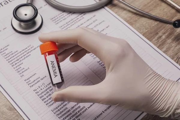 Orvos Kezében Kémcső Vérmintával Címke Vérszegénység Asztal Fölött Közelkép — Stock Fotó