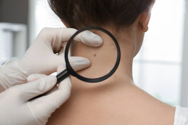Dermatoloog Onderzoekt Moedervlek Van Patiënt Met Vergrootglas Kliniek Close View — Stockfoto