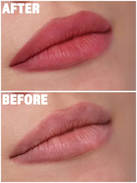Collage Con Fotos Mujer Joven Antes Después Maquillaje Labial Permanente — Foto de Stock