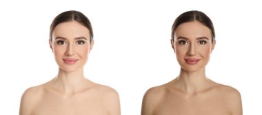 Beyaz arka planda bronzlaşmadan önce ve sonra güzel genç bir kadının fotoğraflarıyla kolaj. Pankart tasarımı