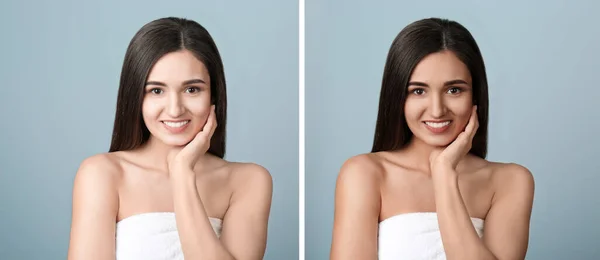 Collage Avec Des Photos Belle Jeune Femme Avant Après Bronzage — Photo